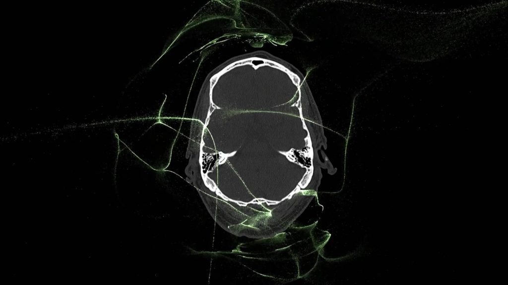 nexus EEG Installation brain with abstract lines